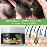 Raw Batana Oil for Hair Growth and Repair -100% Pure, Unrefined Oil from Honduran Rainforests Prevent Hair Loss and Enhances Hair Thickness in Men & Women