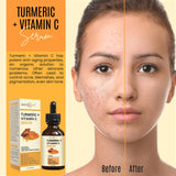 DERMAXGEN Turmeric Face Serum + Vitamin C: Organic Moisturizer for Acne Reduction, Clear Skin Tone, & Anti-Aging Benefits - Hydrate Dull & Dry Skin - Facial Serum - 2 FL OZ