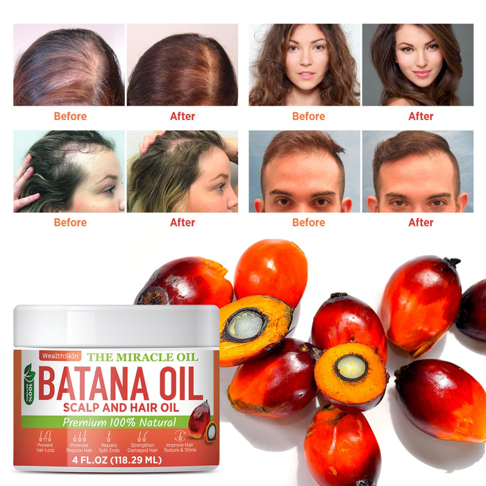 WEALTHSKIN Batana Oil for Hair Growth: 100% Batana Oil from Honduras as Hair Mask, Scalp and Hair Oil. Repairs Damaged Hair & Skin, Reduces Hair Loss 4oz (4oz (118ml))