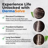 Dermasolve 4 oz Psoriasis, Seborrheic Dermatitis, & Dandruff Scalp Oil | Dermatologist Approved | Itchy, Flaky Scalp Relief | Clinically Tested, Long-Lasting Itch-Free, High-Performance Formula