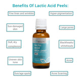 LACTIC Acid 35% Skin Chemical Peel- Alpha Hydroxy (AHA) For Acne, Skin Brightening, Wrinkles, Dry Skin, Age Spots, Uneven Skin Tone, Melasma & More (from Skin Beauty Solutions) - 1oz/30ml