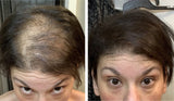 Caboki Hair Loss Concealer, 90-day supply, Dark Brown