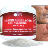 ALKA VITA Acne Scars Silicon & Collagen Skin Polishing Crystals Gel For Indented Rolling Atrophic & Keloid Scars Natural Ingredients By, Clear, 4.0 Fl Oz, (Pack of 1)