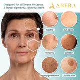 Abera Melasma Serum with Niacinamide and Hyaluronic Acid, Dark Spot Corrector Serum, Melasma Treatment for Face, Suitable for All Skin Types, 0.68 fl. Oz, Set of 3