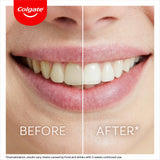 COLGATE Max White Ultimate Overnight Teeth Whitening Pen, Reverses 15 Years Of Stains* 2.5ml, 1 Pack, 35 Nightly Treatments