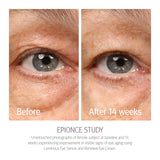 EPIONCE Renewal Eye Cream - Anti-Aging, Dark Circles & Puffiness, Hyaluronic Acid, Under Eye Brightener
