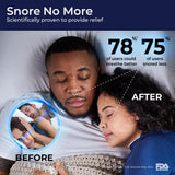 MUTE by Rhinomed Nasal Dilator for Snore Reduction | Small 3pk | Increase Airflow | Anti Snoring Devices | Nasal Dilators for Sleeping | Internal Nasal Dilator | Snoring Solution | Transparent