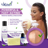Naturasil Tinea Versicolor Treatment Soap 10% Anti-Itch Natural Micronized Sulfur Wash | Works for Pityriasis, Candida, Ringworm & Irritation | Fast Acting & Safe for Kids & Adults | 4 oz Bar (2)