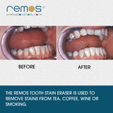 REMOS Tooth stain eraser - polisher for discolourations by tobacco, tea, coffee & wine