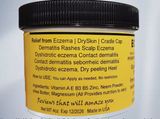 Intense Treatment for Eczema Psoriasis Rosacea baby eczema Eczemaout Acne 4oz