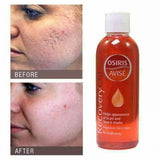 Osiris Avise Recovery Oil **Helps Appearance Of Scar & Stretch Marks** 100ml