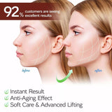 SUPERGAO V-line Face Chin Cheek Lift Up Slimming Mask Anti Wrinkle Strap Band Reusable