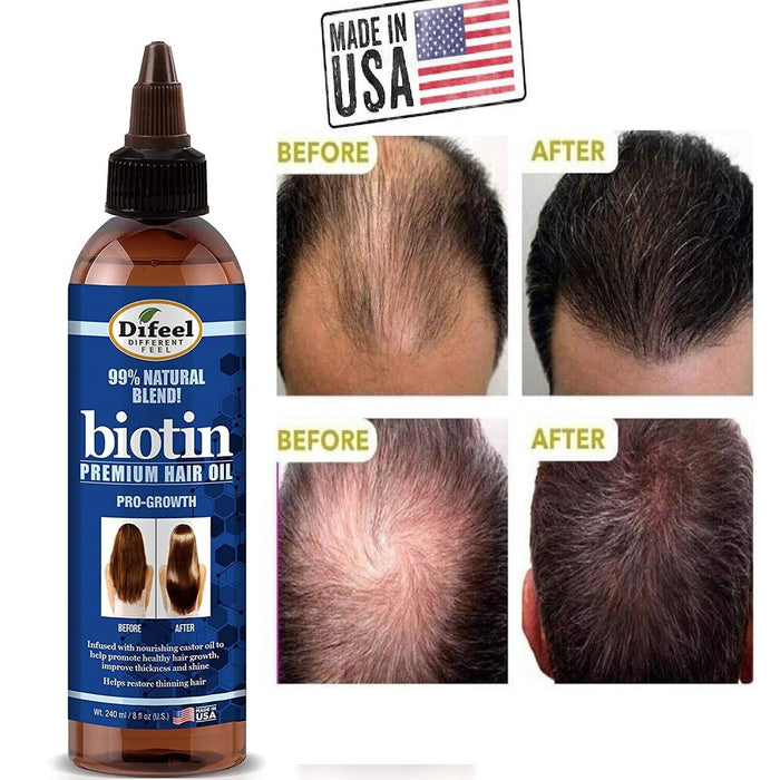DIFEEL Biotin Oil to Help Prevent Hair Loss Hair Loss 99% Natural Blend
