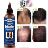 DIFEEL Biotin Oil to Help Prevent Hair Loss Hair Loss 99% Natural Blend