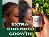 " THEANOINTEDFLOW Organic Black Rice Oil for FAST Growth Dry Scalp Rice Peppermint Black Seed"