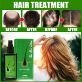 GREEN WEALTH 100% Natural 30/120ml Neo Hair Lotion Root Treatment Nutrients Beard Hair Growth