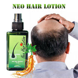 GREEN WEALTH 100% Natural 30/120ml Neo Hair Lotion Root Treatment Nutrients Beard Hair Growth