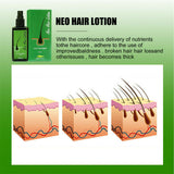 GREEN WEALTH 100% Natural 30/120ml Neo Hair Lotion Root Treatment Nutrients Beard Hair Growth