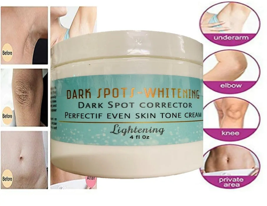 Dark Skin Whitening Dark spot Brightening Bleaching Lightening Cream face