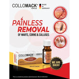 1 X COLLOMACK TOPICAL 10ml Painless Remover Plantar Warts Corns And Calluses