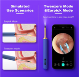 BEBIRD Note3 Pro Visual Smart 10 Megapixel HD Ear Wax Removal Endoscope Camera