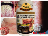 Parasite Detox Worm parasite cleanse colon support anti worm detox clean support fungus colon