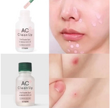 AC Clean Up Pink Powder Spot 15ml x 1PC Calamine Spot Care