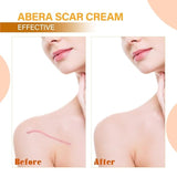 ABERA Red Turmeric Scar Removal Cream (Premium Product) - Advanced Treatment for Face and Body with Natural Ingredients Scar Rapidly Removes Stretch Marks, Keloids, Burns, and More.