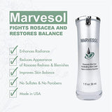 Marvesol Rosacea Cream Lotion Serum for Face Skin | Soothes & Reduces Rosacea Redness Acne & Blemishes | Enhances Radiance | Provides a Balanced State for Skin | Gentle on Skin | Made in USA (30 ml)