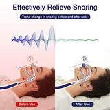 Anti Snoring Device, Adjustable Wind Speed Snoring Solution, Electric Anti Snoring Devices Nasal Dilator Nose Vents Plugs,Stop Snoring Suitable for Men and Women