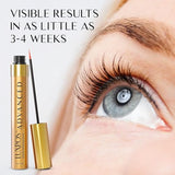 Eyelash Growth Serum: Get Thick, Strong Lashes in Just 3-4 Weeks with Our Plant-Based Eyelash Growth Serum - No Parabens or PG (5 ML)