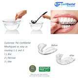 The ConfiDental - Pack of 5 Moldable Mouth Guard for Teeth Grinding Clenching Bruxism, Sport Athletic, Whitening Tray, Including 3 Regular and 2 Heavy Duty Guard (3 (LLL) Regular 2 (II) Heavy Duty)