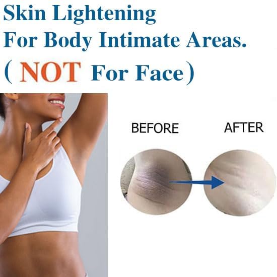 Skin Lightening Cream Skin Bleaching Cream Whitening Cream For Body Intimate Area, Private Parts, Underarm, Knees, Elbows, Inner Thigh, Bikini Areas