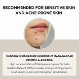 SKIN1004 Madagascar Centella Asiatica Ampoule Facial Serum 1.85 fl.oz, 55ml, Soothes Acne Prone and Sensitive Skin