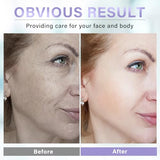 Dark Spot Remover For Face, Hyperpigmentation Treatment, Dark Spot Corrector, Discoloration Correcting Serum, Dark Spot Wand