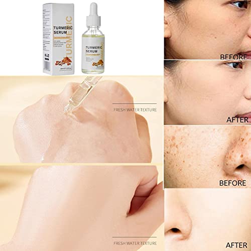 𝟐𝟎𝟐𝟒 𝐔𝐩𝐠𝐫𝐚𝐝𝐞𝐝 New Turmeric Dark Spot Corrector Serum, Turmeric Repair Face Serum, Bright Skin Dark Spot Corrector Face, Hydrate Dull & Dry Skin (2PCS*30ML).