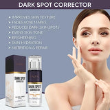 VALITIC Dark Spot Corrector for Face - Kojic Acid, Vitamin C & Retinol – Infused with Niacinamide & Glycolic Acid, Hyperpigmentation & Post Acne Marks- 30 ML