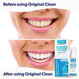 EverSmile AlignerFresh Original Clean - AlignerFresh Cleaning Foam for Invisalign, ClearCorrect, Essix, Hawley Trays/Aligners. Cleans, Eliminates Bacteria, Whitens Teeth & Fights Bad Breath