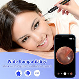 Ear Wax Removal Tool, LMECHN Ear Cleaner with 1920P HD Camera, Earwax Remover with 8 Pcs Ear Set, Otoscope with 6 LED Lights, Ear Wax Removal Kits for iPhone, iPad, Android Phones