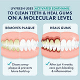 LIVFRESH Toothpaste Gel, Clinically Proven to Remove Plaque 250% Better, Improves Gum Health 190% Better, Prevents & Reduces Tartar, Freshens Breath, SLS Free, Non-Foaming Dental Gel, Peppermint