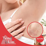 Tend Skin The Skin Care Solution For Unsightly Razor Bumps, Ingrown Hair And Razor Burns, 8 Fl Oz Bottle