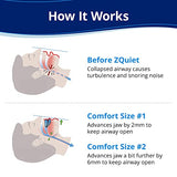 ZQuiet, Anti-Snoring Mouthpiece, Starter Pack with 2 Sizes, Living Hinge & Open Front Design for Comfort & Easy Breathing, Clear
