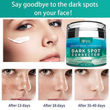 Paradise Emerald Dark Spot Remover for Face, Hyperpigmentation Treatment, Melasma, Freckle, Sun Spots Removal for All Skin Types Dark Spot Corrector for Men and Women