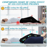 Wedge Pillow for Sleeping - Inflatable Leg Elevation Pillow for Swelling,Circulation,Leg & Back Pain Relief,Leg Support Pillow,Leg Wedge Pillows for After Aurgery,Hip,Foot,Ankle Recovery (Blue)