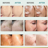 CITYGOO Dark Spot Remover for Face: Dark Spot Corrector Cream - Natural Ingredient,Enriching Skin Care For All Skin Tones - Melasma, Freckle, Sun Spot Remover & Blemish Reducer-1.7 FL OZ