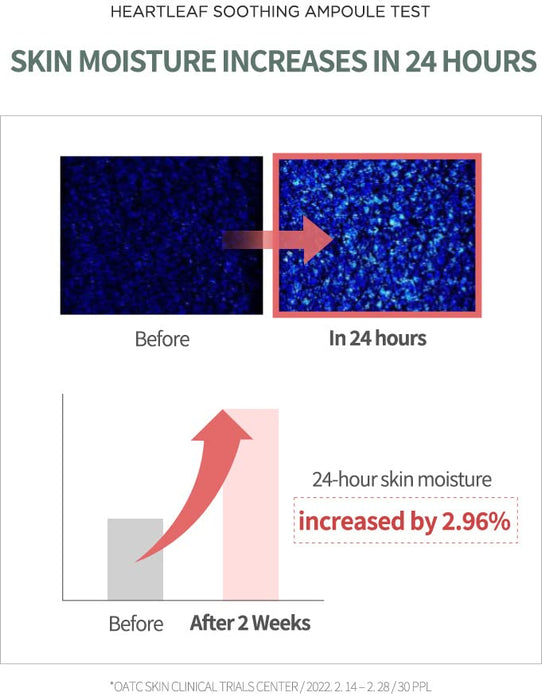 Anua Heartleaf 80% Soothing Ampoule 30ml / 1.01 fl.oz. I non-greasy, highly concentrated skin calm serum hydrating panthenol B5 calming treatment essence for combination, sensitive, normal skin, Korea