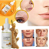 𝟐𝟎𝟐𝟒 𝐔𝐩𝐠𝐫𝐚𝐝𝐞𝐝 New Turmeric Dark Spot Corrector Serum, Turmeric Repair Face Serum, Bright Skin Dark Spot Corrector Face, Hydrate Dull & Dry Skin (2PCS*30ML).