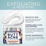 BellamiLuxx Butt & Thigh Acne Clearing Cream - Moisturizing & Exfoliating 1.7 Fl Oz for Acne Prone Skin
