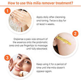 Milia Remover, Milia Spot Treatment Helps Dissolve and Reduce Milia, Whitehead, and Sebaceous Hyperplasia