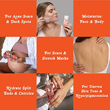 Bio-Oil Skincare Body Oil, Vitamin E, Serum for Scars & Stretchmarks, Face & Body Moisturizer, 2 oz, All Skin Types (Pack of 24)